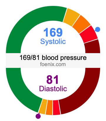 169/81 Blood Pressure: Is It High, Low, or Just Right? Find Out Now!