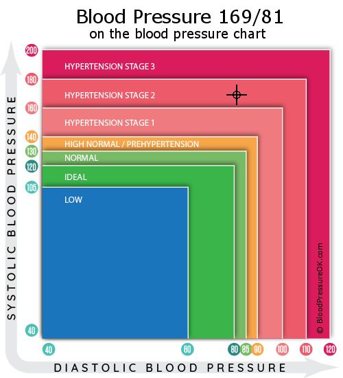 169/81 Blood Pressure: Is It High, Low, or Just Right? Find Out Now!